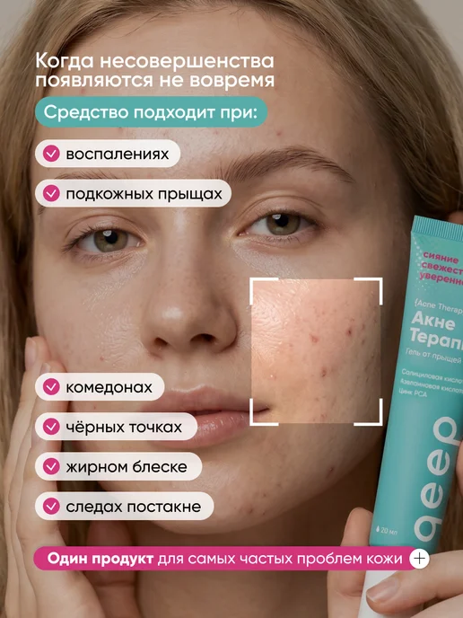 QEEP Крем корректор точечный против прыщей, вариант, фото 2