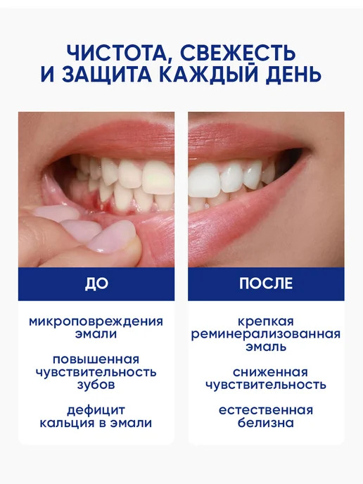 PROFILAX Зубная паста от кариеса 100 гр, 100 г, фото 5