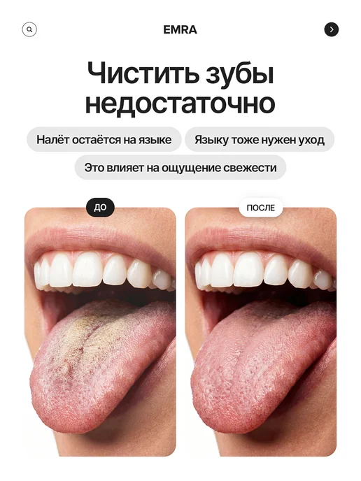 EMRA Скребок щетка для языка, черный, фото 2