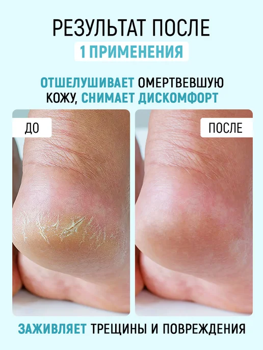 Corimo Профессиональный набор для педикюра, 250 мл, 250 мл, фото 4
