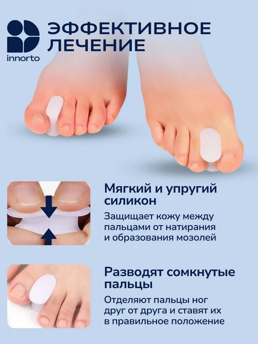 INNORTO Разделители для пальцев ортопедические силиконовые для ног, белый, фото 3