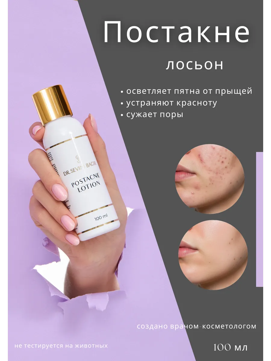 Постакне лосьон от пигментных пятен и рубцов