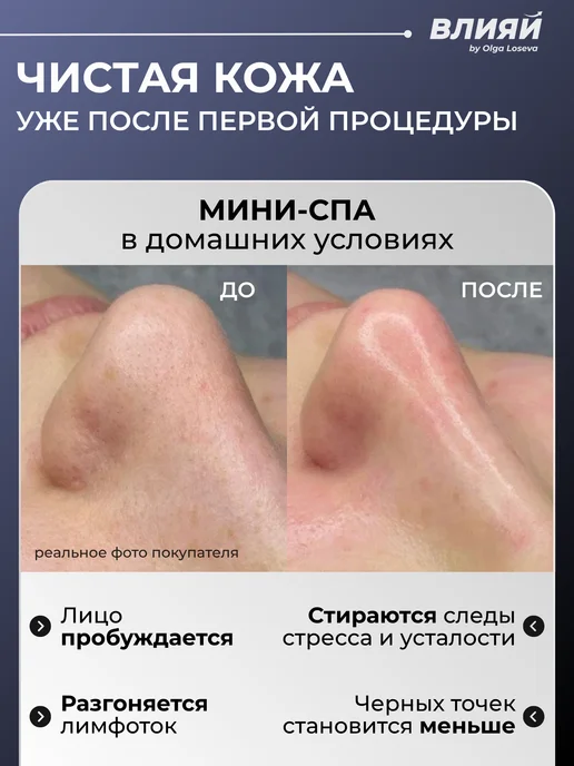 ВЛИЯЙ by Olga Loseva Аквапилинг Вакуумный очиститель пор Чистка лица, белый, фото 2