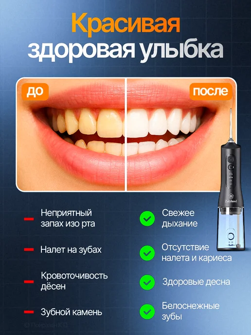 Xiaomi Ирригатор для зубов и десен портативный, черный, фото 4