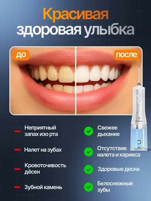 Xiaomi Ирригатор для зубов и десен портативный, вариант, фото 4