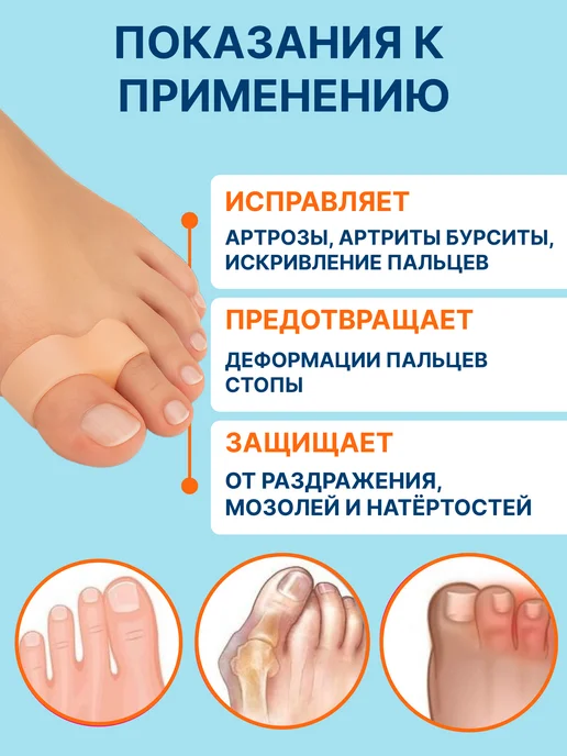 Медруна Разделитель для пальцев ног силиконовый, бежевый, фото 2